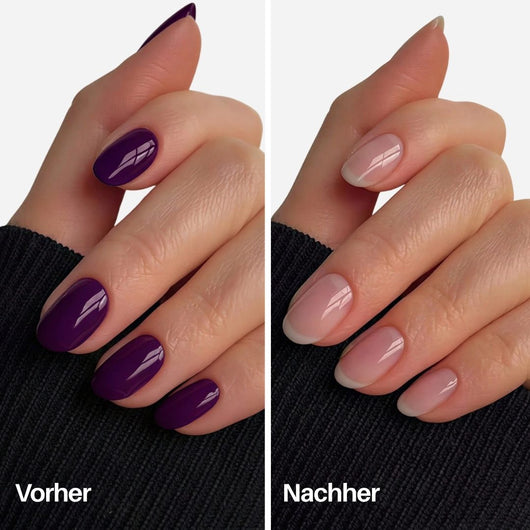 Nagellackentferner : Vorher / Nachher auf den Nägeln