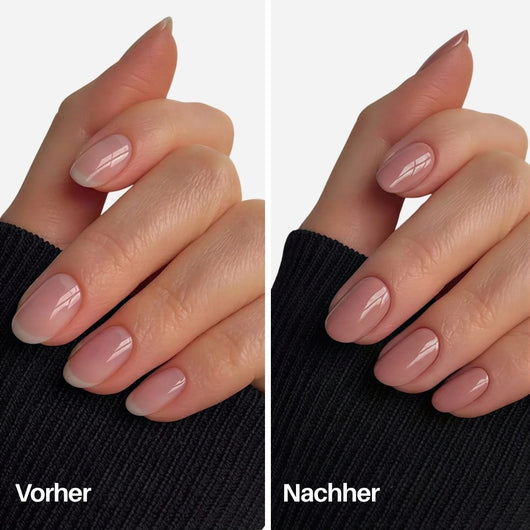 Nude Nail Pen : Vorher / Nachher auf den Nägeln
