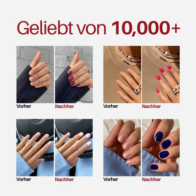 Violet Nail Pen : geliebt von über 10.000 Frauen, Vorher / Nachher von Kundinnen